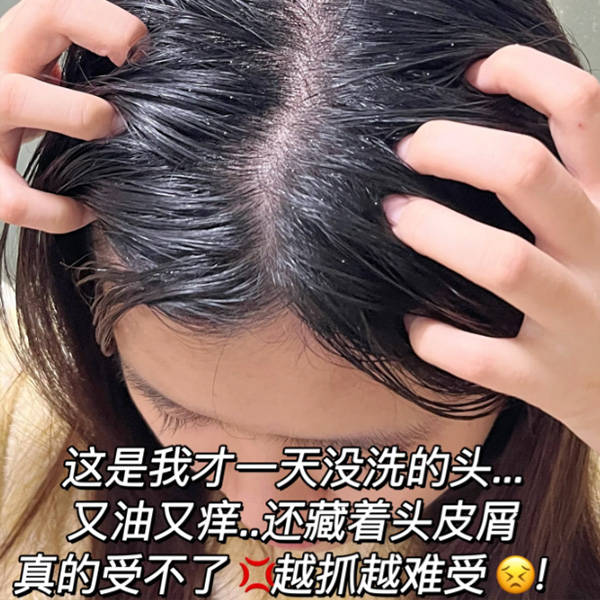 它的去屑控油成分真的很多,包括薄荷,迷迭香和茶树精油等等,使用后