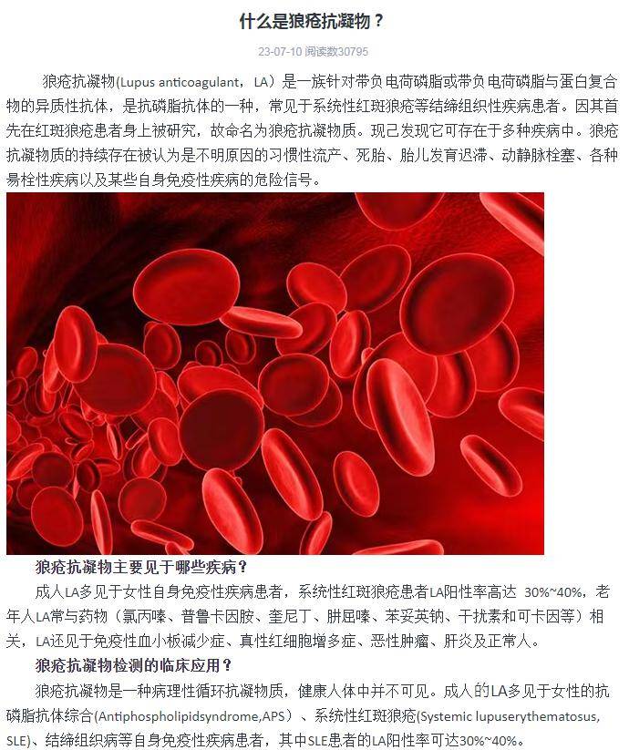 什么是狼疮抗凝物?
