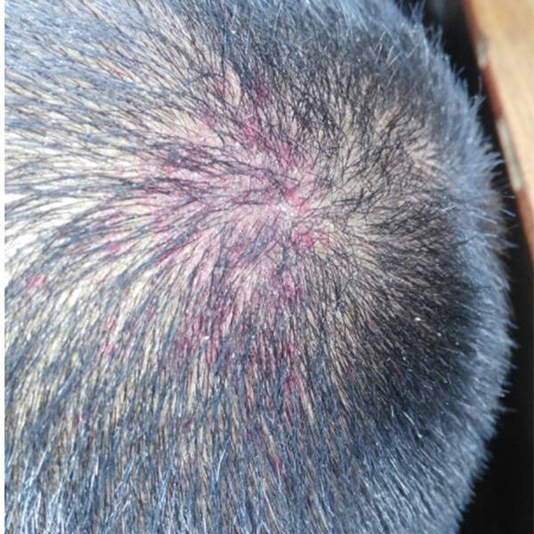 头发_头皮屑_洗头膏