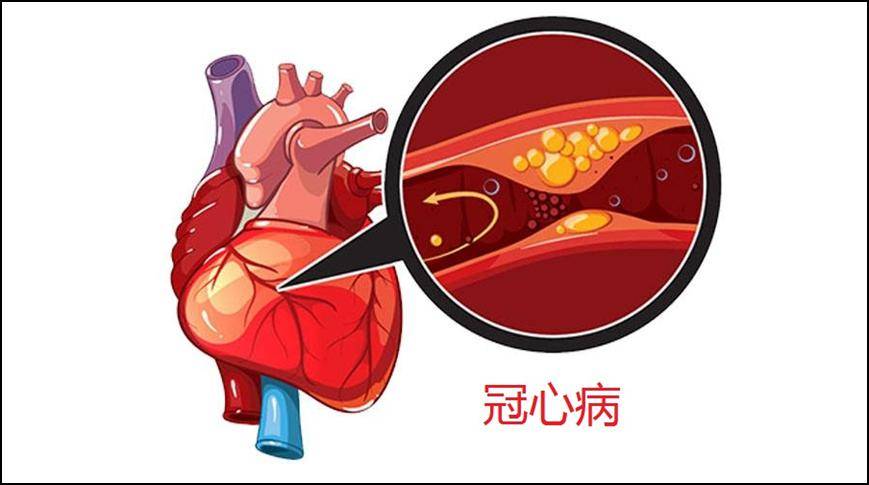 心脏前壁和前间壁实图图片