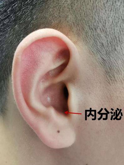 内分泌穴:位于屏间切迹内,耳甲腔的前下部,约距屏间切迹边缘0