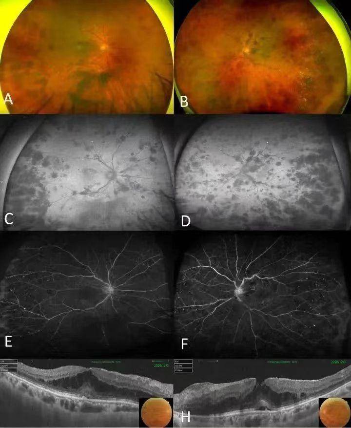 2023年度盘点丨勇攀高峰 锐意进取,北京协和医院教授.