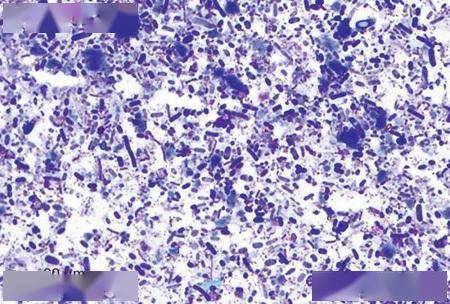 9张镜检图片总结粪便检查中的正常发现:酵母菌,植物,黏液,上皮细胞