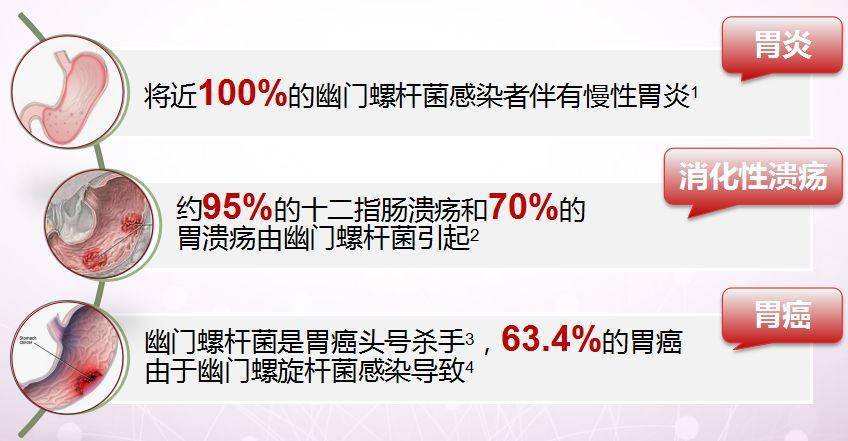 螺杆菌感染是一系列胃部疾病的罪魁祸首那么幽门螺杆菌感染有哪些危害