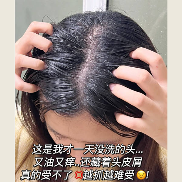 最新推荐_头皮_问题_头发