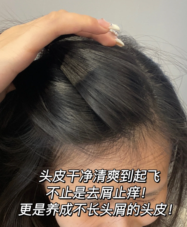 控油去屑洗发水排行榜10强_头皮_问题_头发