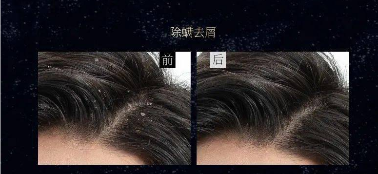 男士去屑洗发水推荐_头发_问题_黛熙