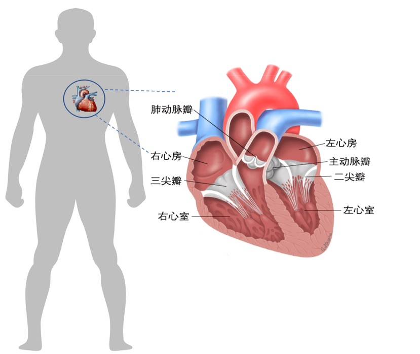 科普|聊聊肥厚型心肌病(hcm)那些事_患者_心脏_临床