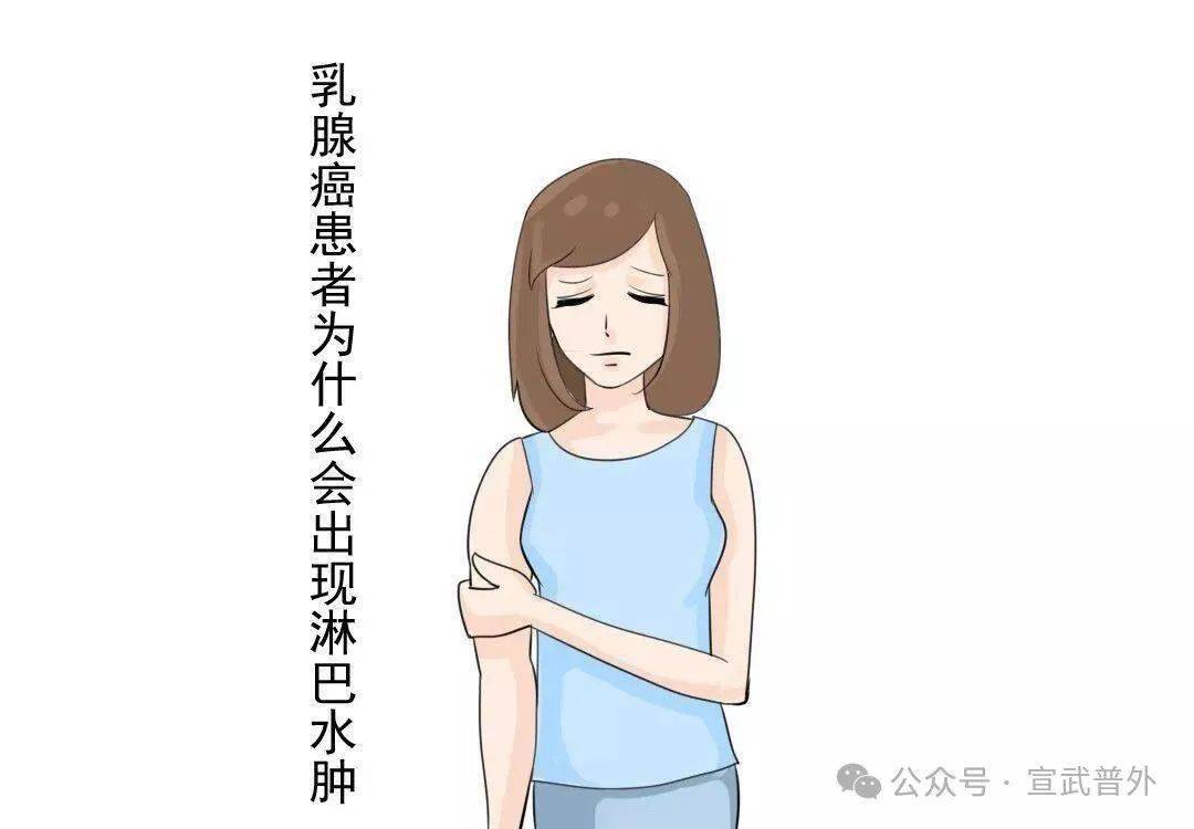 乳腺癌术后如何判断自己有没有出现淋巴水肿?_测量_患者_部位