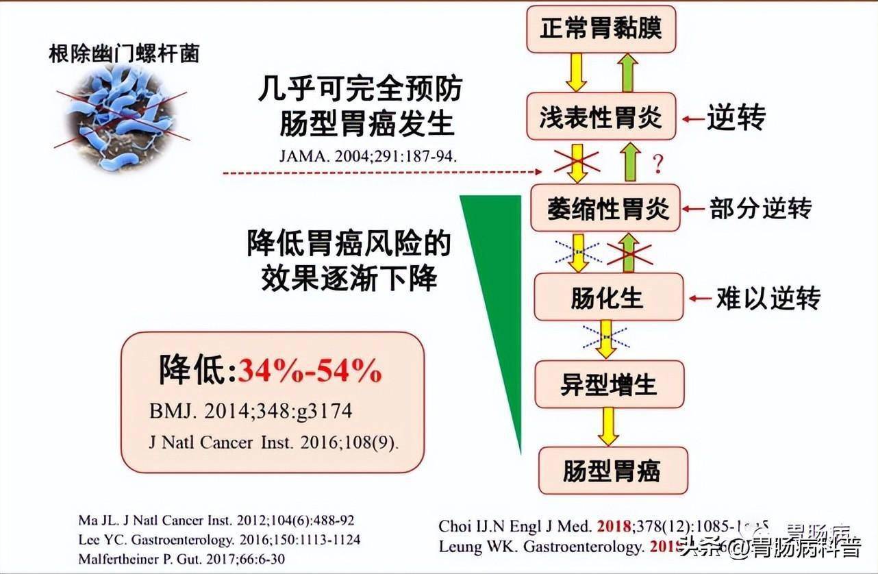 萎缩性胃炎转癌要几年图片