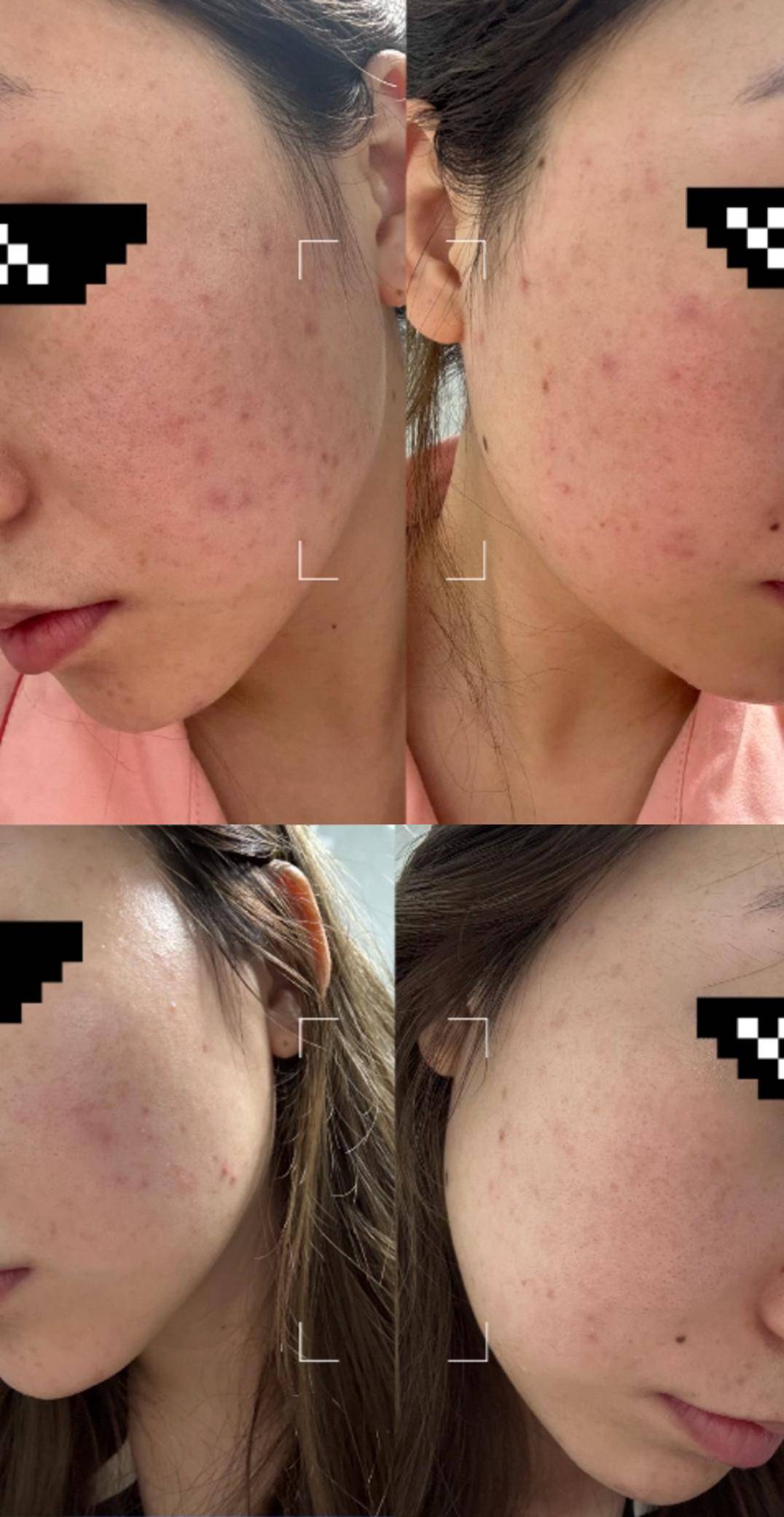 2月29日三八大促等你!_皮肤_版本_红宝石