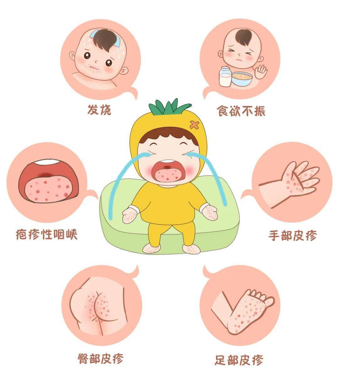 提醒:請家長近期密切關注孩子_兒童_症狀_幼兒