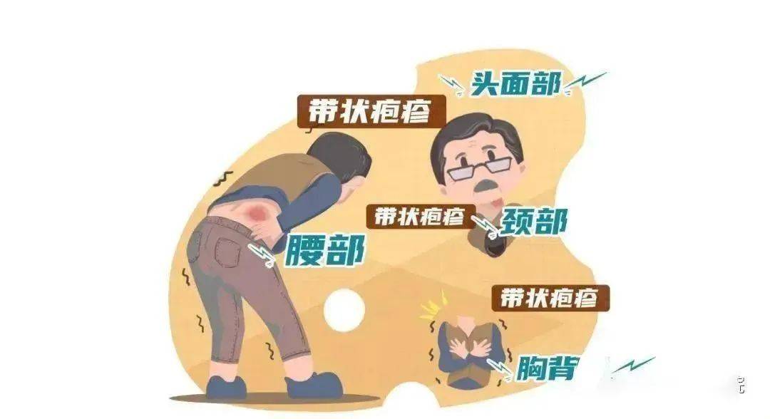 缠腰丹长满一圈会死人图片