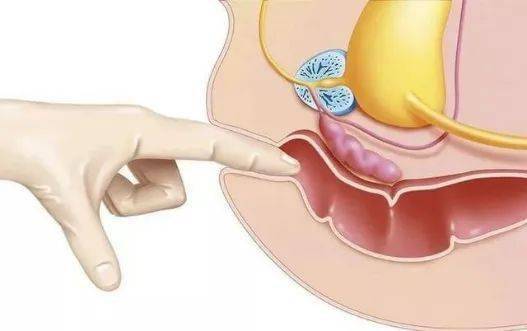 新年新气象——中医肛肠科上"新"啦_肛门_患者_检查