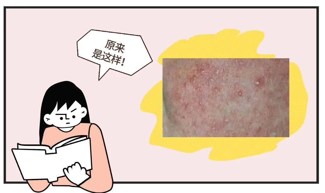 女演员因病去世年仅19岁从确诊到离世仅10天警惕这种病