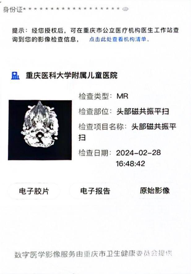 可选择支付15元/次实体胶片打印费,并主动告知放射科登记窗口人员办理
