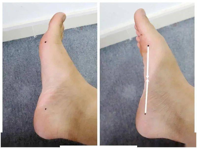 踝内翻站立如果有脚踝外侧痛或者踝扭伤史,不适合做该动作.