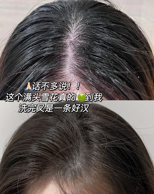 去屑止痒的洗发膏