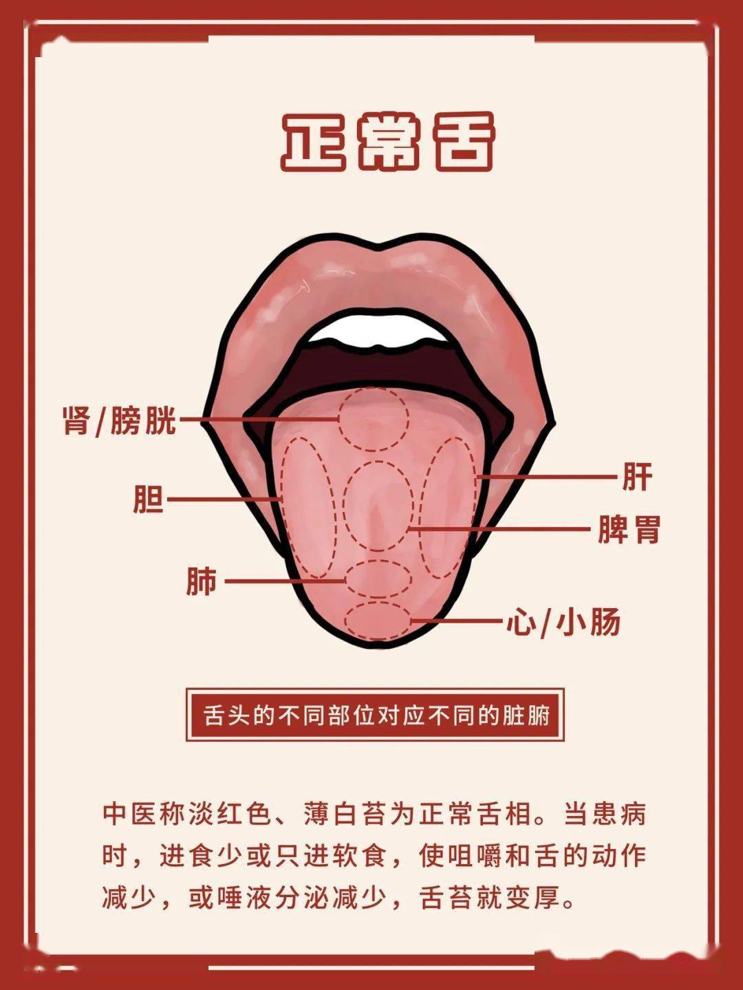 舌头和疾病对照图片图片