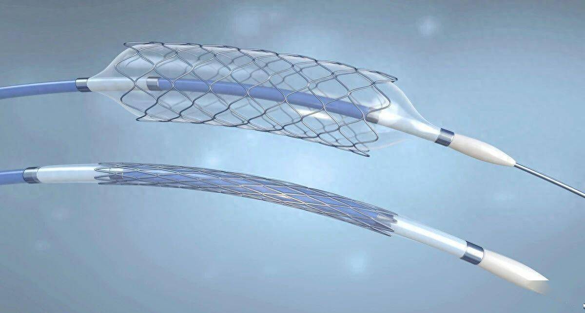 医生不愿用集采支架做手术?回应来了→