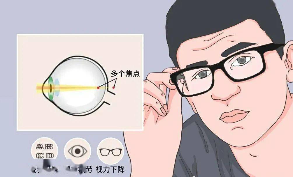 散光为什么会导致视疲劳