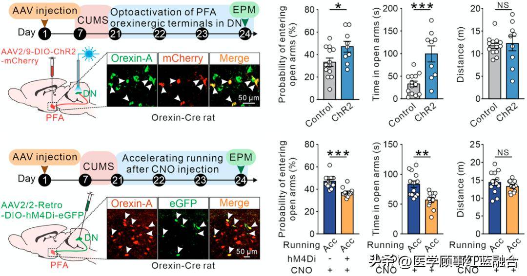 神经元揭示运动缓解焦虑的神经通路关键竟在小脑