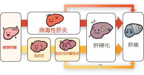 肝脏米老鼠征b超图图片