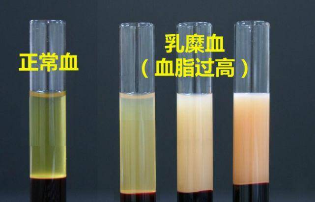 如果超过16小时,血糖,胆固醇,甘油三酯,载脂蛋白,尿素氮降低.