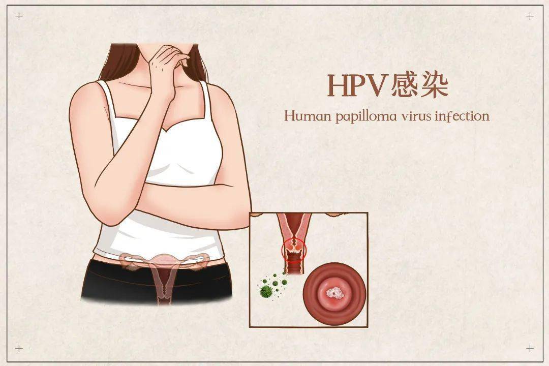 04宫颈糜烂子宫颈是女性生殖系统的一部分,位于子宫和阴道之间,属于内