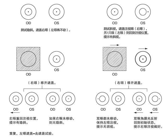 斜视的基本检查法
