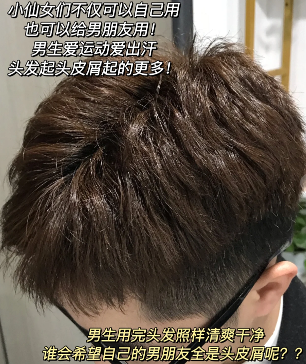 头发_头皮屑_问题