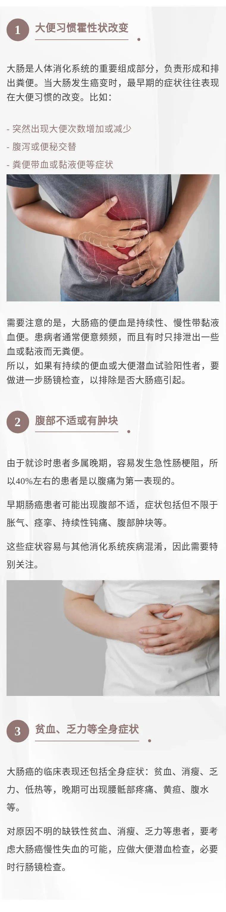 肠癌的早期症状及表现图片