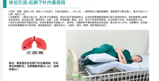 原发性纤毛不动综合征,这样的个性化护理,值得借鉴~_患儿_支气管_进行