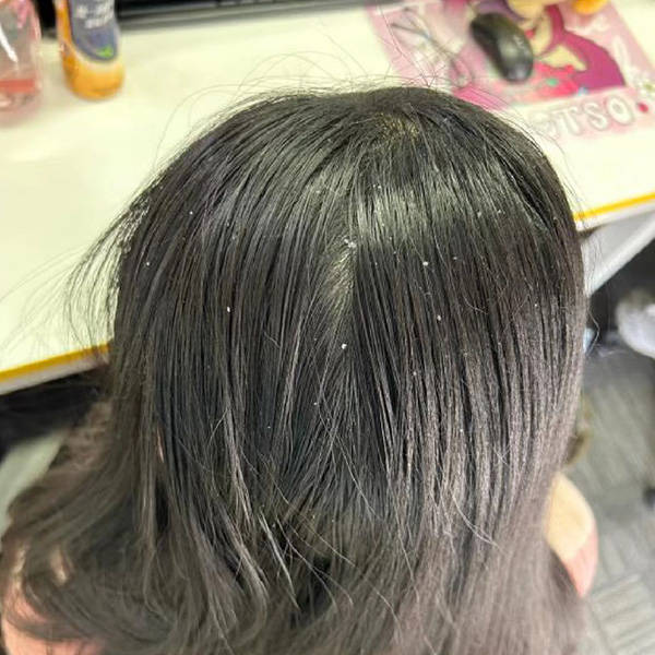 洗发精去油去屑是哪种_头皮_头发_效果
