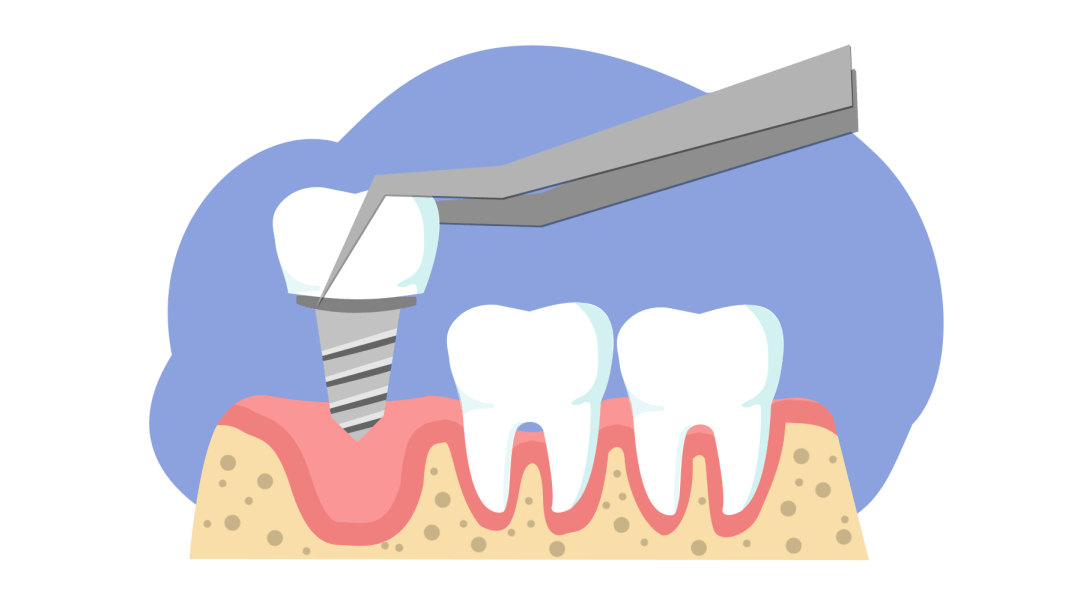 世界口腔健康日 科普专家给您的口腔健康提示_牙齿_治疗_患者