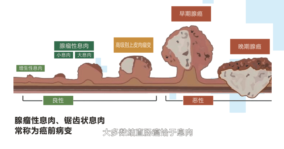 早期直肠肿瘤的症状图片