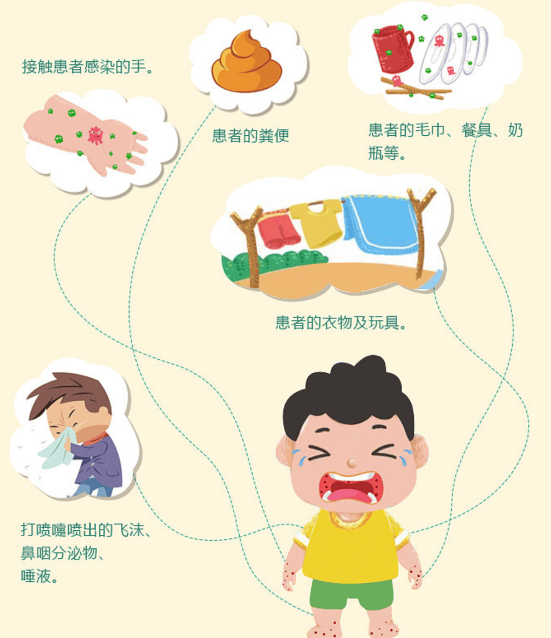 家长请注意手足口病将进入高发期宝宝出现这些症状要小心