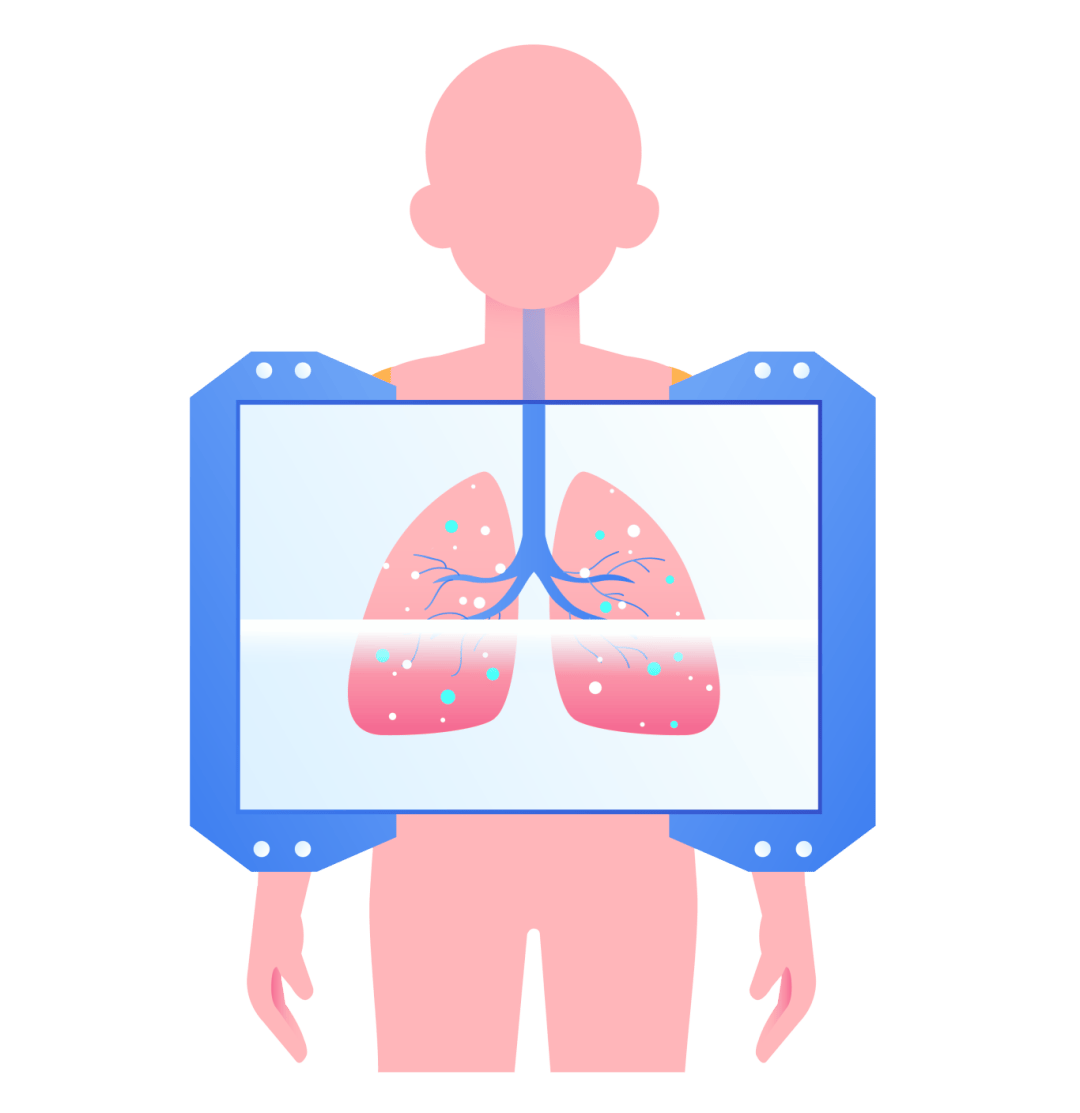 肺结节ct报告单图片