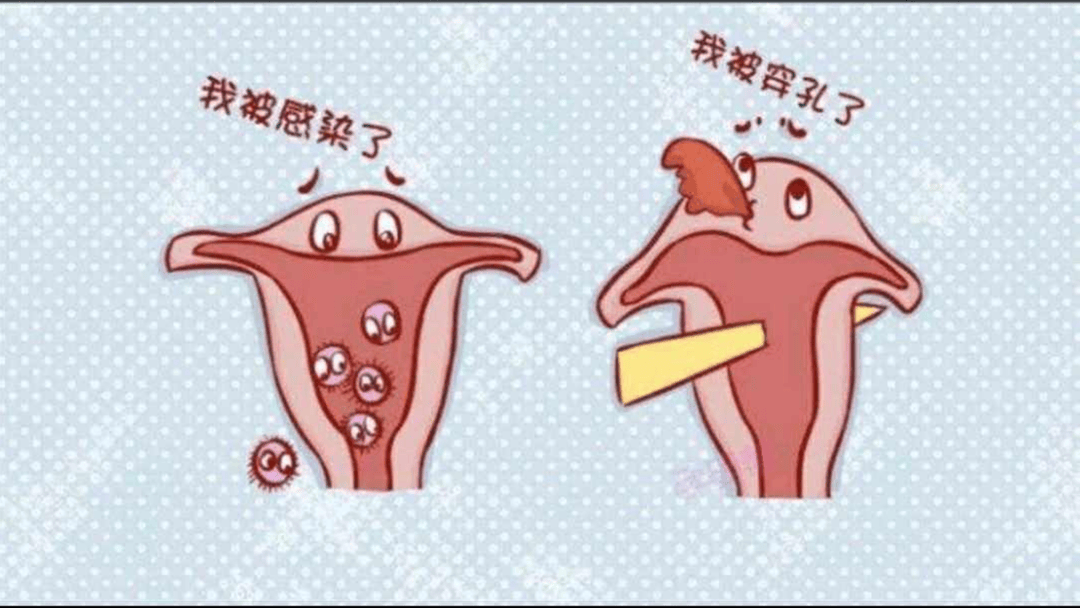 做人流早孕图片