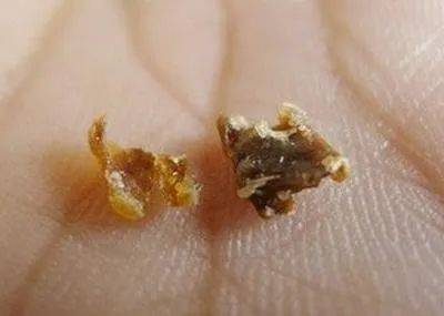 外耳道软骨部皮肤具有耵聍腺，其淡黄色黏稠的分泌物称耵聍，俗称耳屎。