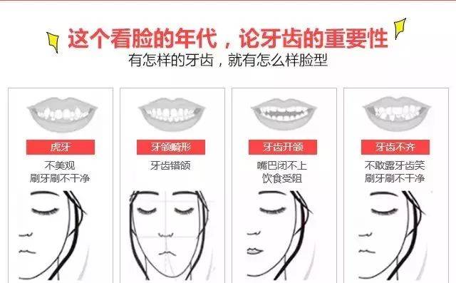 为什么越来越多的人做牙齿矫正