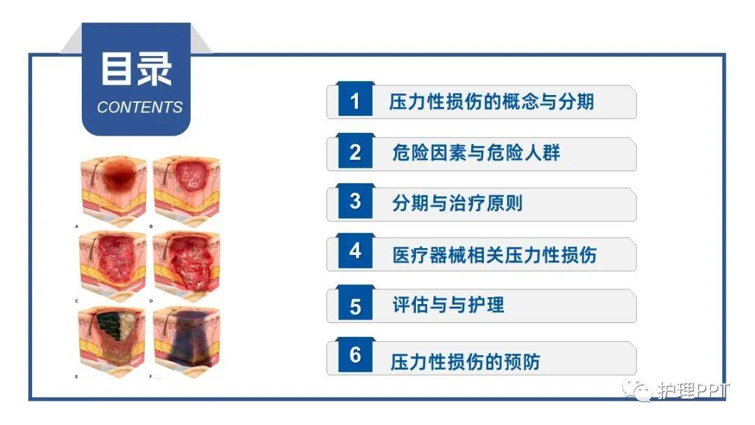 压疮分级最新标准图片图片