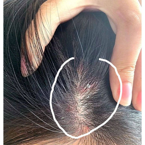 男人有头皮屑用什么洗发水?去屑控油止痒洗发水排行榜_头发_问题_成分