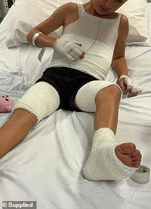 小心澳洲这一常见水果孩子遭受大面积灼伤后悉尼妈妈发出警告