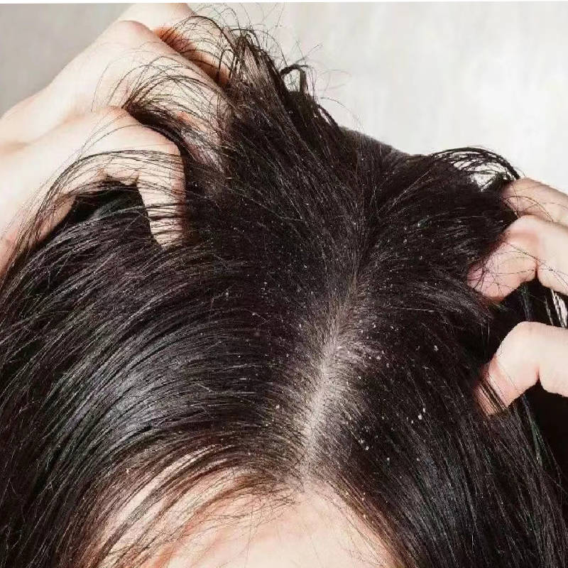 孩子去屑洗发水哪个好止屑止痒不错的洗发水介绍