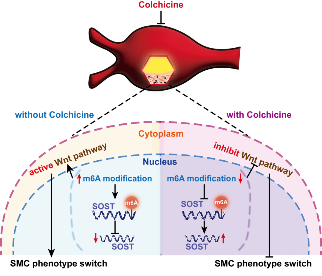 罗淞元团队秋水仙碱通过维持血管平滑肌细胞稳态抑制腹主动脉瘤的形成