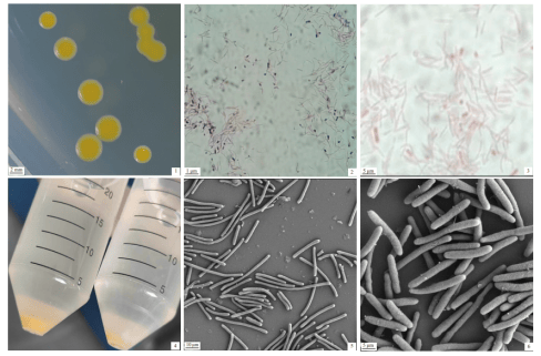 嗜冷黄杆菌,隶属于拟杆菌门(bacteroidetes),黄杆菌属(flavobacterium