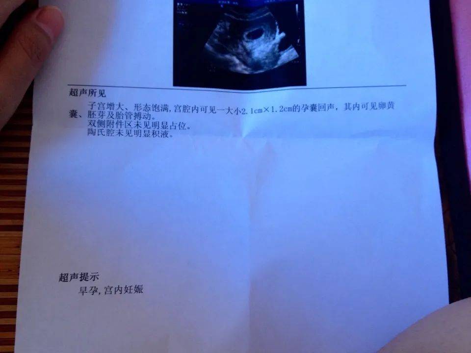 孕检报告单怀孕图片