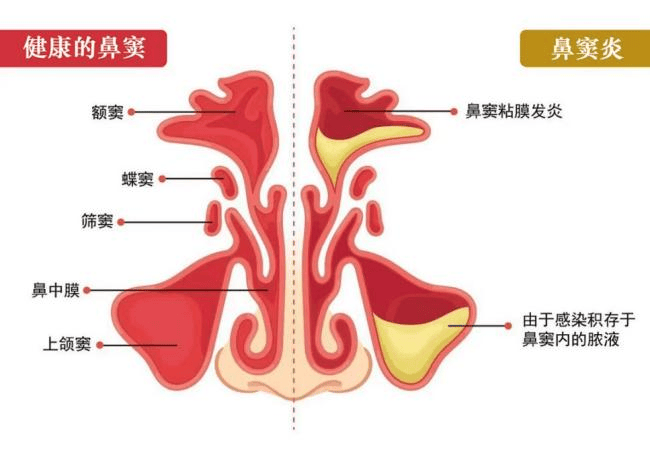 三个鼻道图片图片