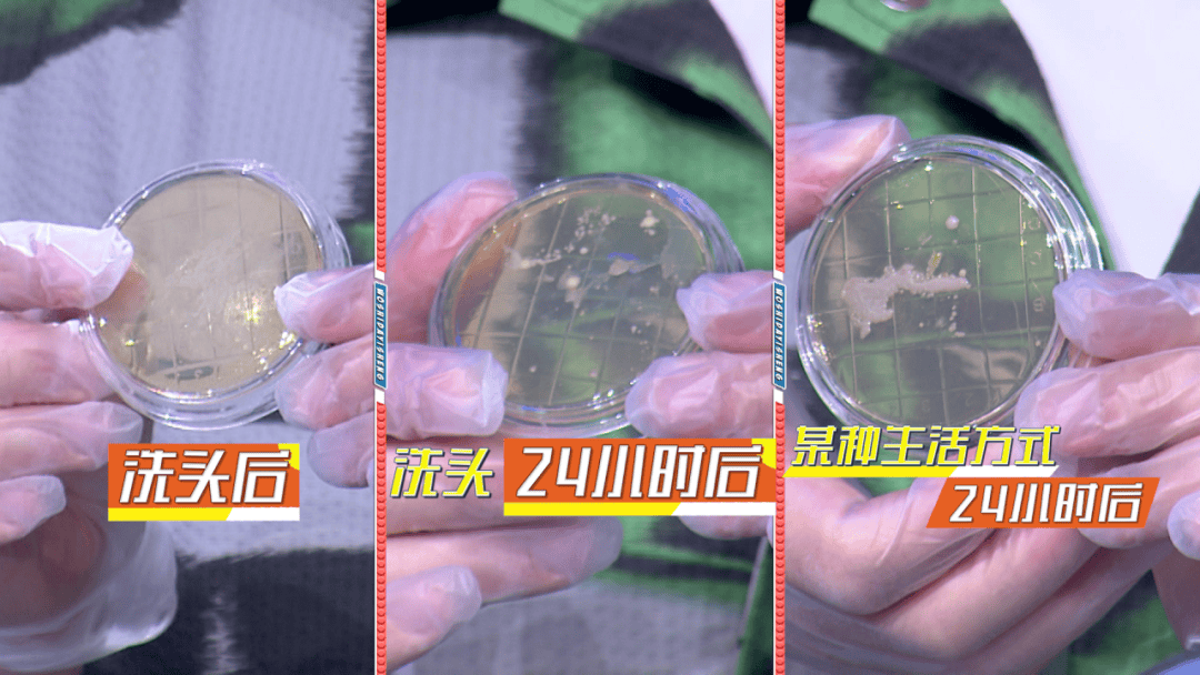 我是大医生头皮保养年轻的头等秘诀